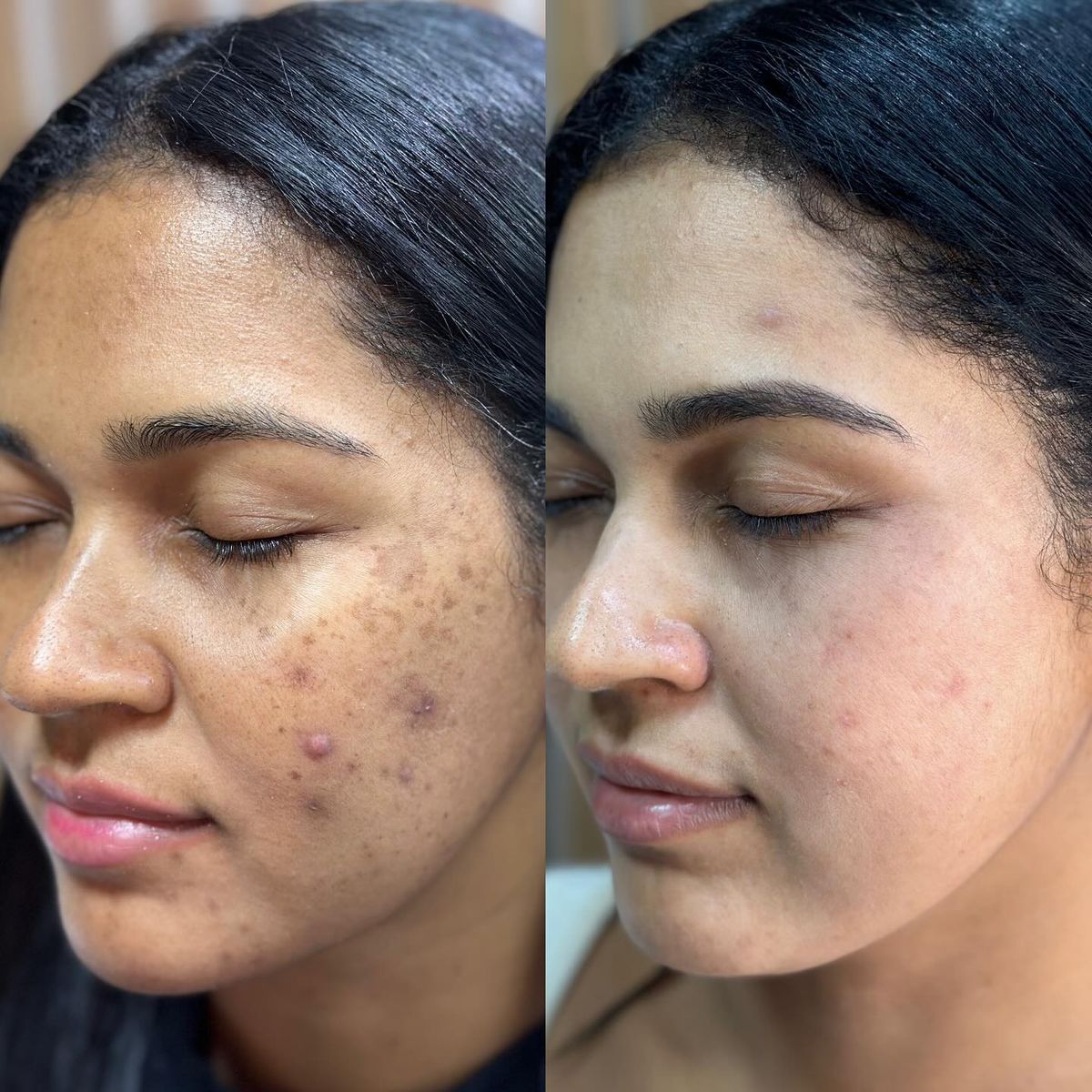 DARK SPOTS ROUTINE